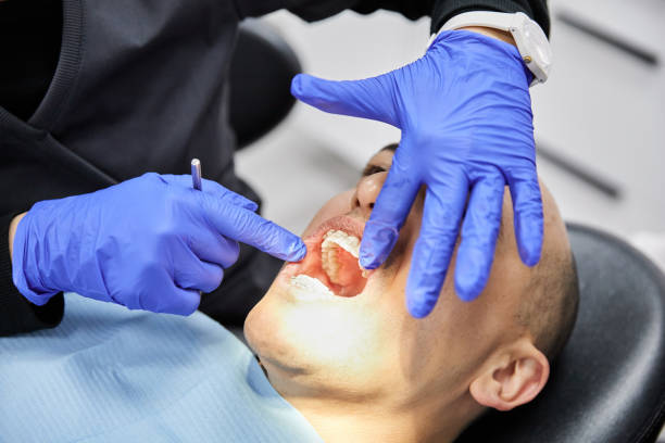 Best Emergency Wisdom Tooth Extraction in Glen Gardner, NJ