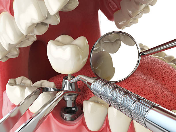 Best Emergency Cosmetic Dentistry (e.g., broken veneers) in Glen Gardner, NJ